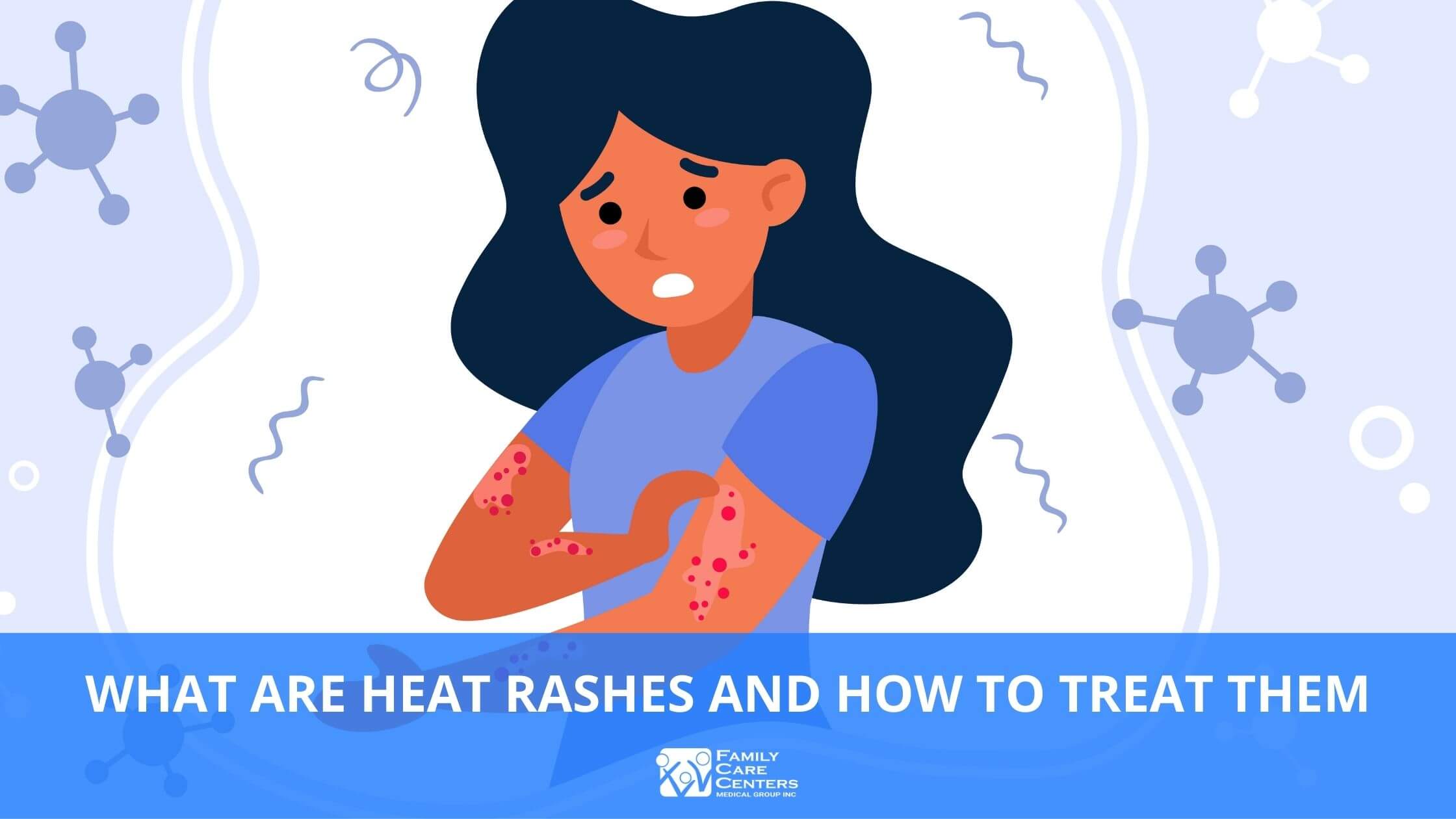 How To Identify, Treat, and Prevent Heat Rash in Children